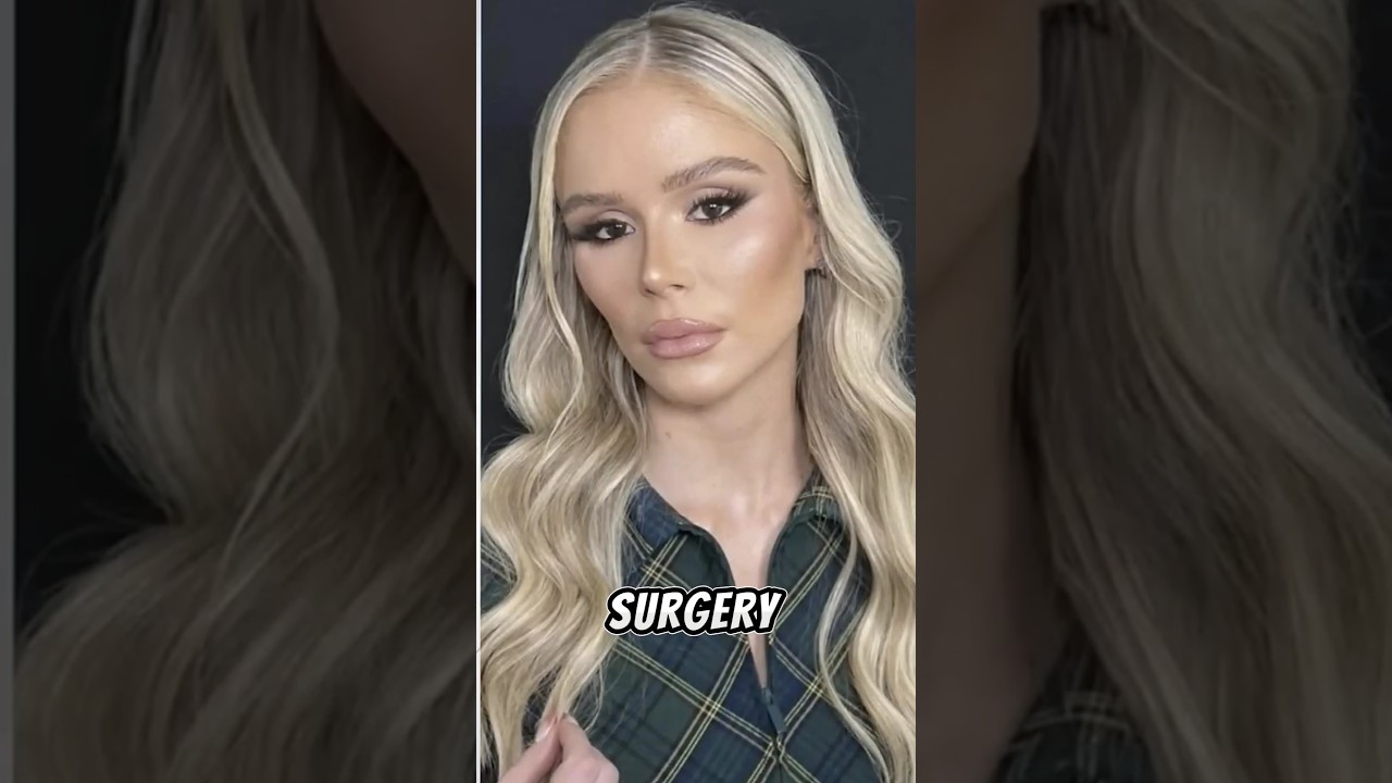 The Boys Actress Erin Moriarty responds to plastic surgery criticism