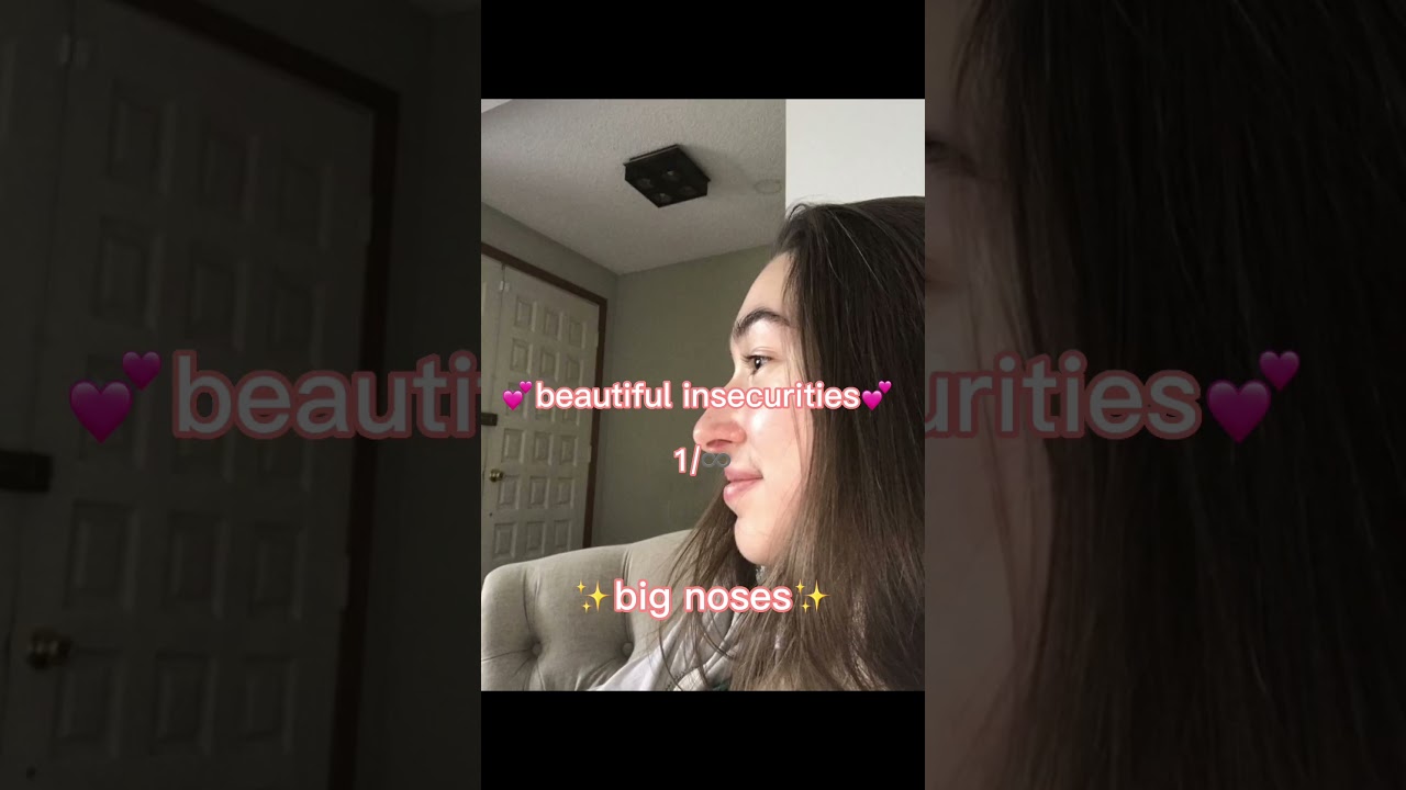beautiful insecurities~ big noses 🤍 1/♾️