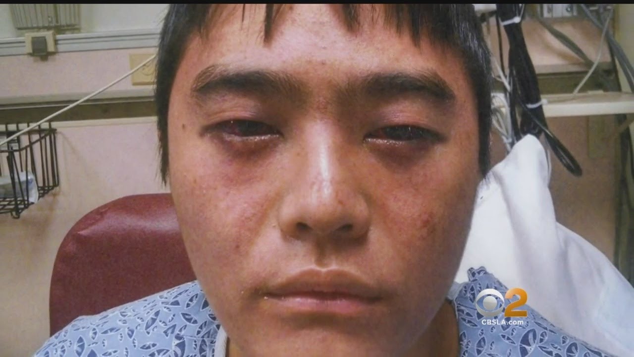 Man Gets $7.4 Settlement After Being Choked By 2 Off-Duty LA Firefighters