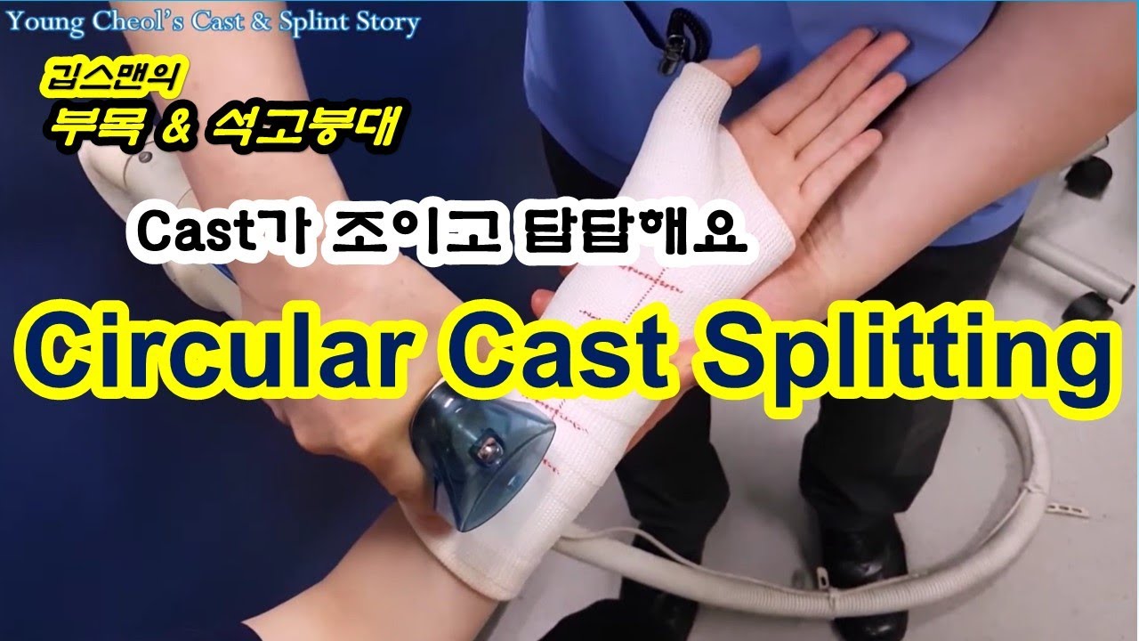 Cast Splitting
