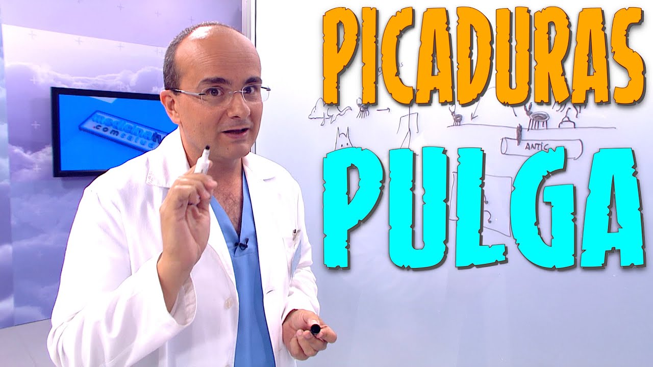 PICADURA DE PULGA, ¿Cómo son? ¿Qué síntomas producen? ¿Cómo hay que actuar? ¿Cómo Prevenirlas?